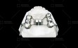 Herbst-Appliance---Cast-Silver-Splint-type-2