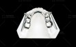 Herbst-Appliance---Cast-Silver-Splint-type3