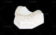 Occlusal-Splint