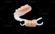 Resure-Partial-Denture-1